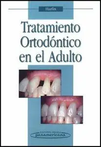 Tratamiento Ortodontico En El Adulto