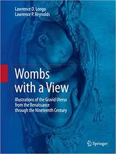 Wombs with a View: Illustrations of the Gravid Uterus from the Renaissance through the Nineteenth Century (Repost)