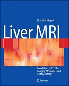 Liver MRI: Correlation with other Imaging Modalities and Histopathology