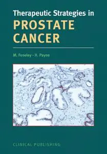 Therapeutic Strategies in Prostate Cancer