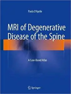 MRI of Degenerative Disease of the Spine: A Case-Based Atlas (Repost)