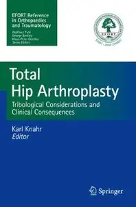 Total Hip Arthroplasty: Tribological Considerations and Clinical Consequences (repost)
