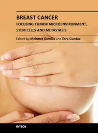 Breast Cancer – Focusing Tumor Microenvironment, Stem Cells and Metastasis by Mehmet Gunduz