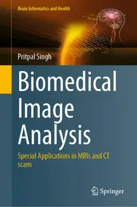 Biomedical Image Analysis: Special Applications in MRIs and CT scans (Brain Informatics and Health)