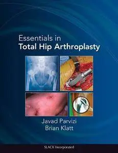 Essentials in Total Hip Arthroplasty(Repost)