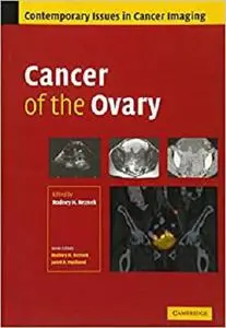 Cancer of the Ovary (Contemporary Issues in Cancer Imaging)