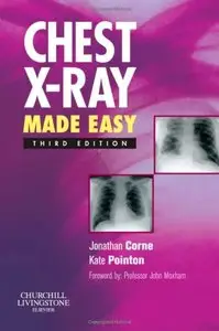 Chest X-Ray Made Easy, 3rd edition