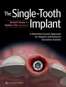 «The Single-Tooth Implant: A Minimally Invasive Approach for Anterior and Posterior Extraction Sockets» by Dennis P. Tar