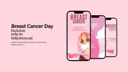 Breast Cancer Instagram Stories 48036944