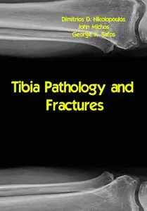 "Tibia Pathology and Fractures" ed. by Dimitrios D. Nikolopoulos, John Michos, George K. Safos