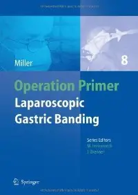 Laparoscopic Gastric Banding