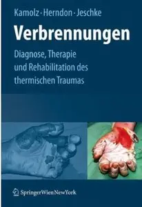 Verbrennungen: Diagnose, Therapie und Rehabilitation des thermischen Traumas (repost)