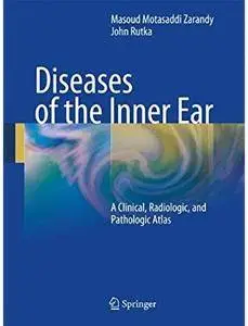 Diseases of the Inner Ear: A Clinical, Radiologic, and Pathologic Atlas