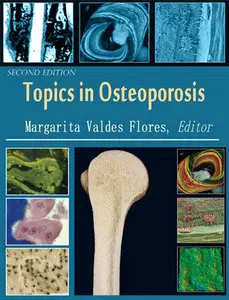 "Topics in Osteoporosis" ed. by Margarita Valdes Flores