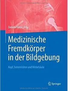 Medizinische Fremdkörper in der Bildgebung: Kopf, Extremitäten und Wirbelsäule [Repost]