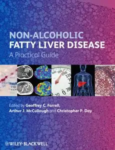 Non-Alcoholic Fatty Liver Disease: A Practical Guide