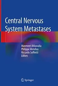 Central Nervous System Metastases (Repost)