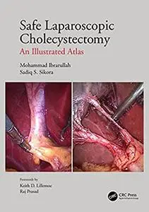 Safe Laparoscopic Cholecystectomy: An Illustrated Atlas