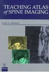 Teaching Atlas of Spine Imaging (repost)