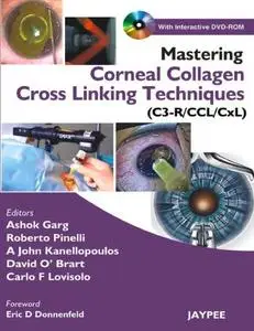 Mastering corneal collagen cross linking techniques