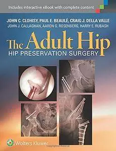 The Adult Hip: Hip Preservation Surgery (repost)