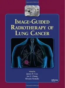 Image-Guided Radiotherapy of Lung Cancer