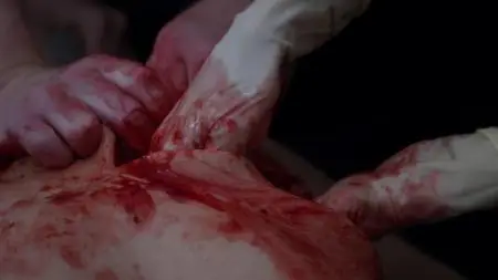 Grey's Anatomy S15E09