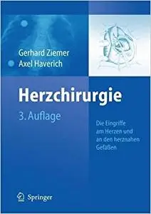 Herzchirurgie: Die Eingriffe am Herzen und an den herznahen Gefäßen