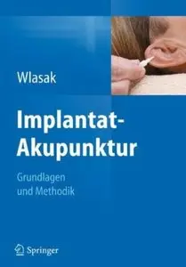 Implantat-Akupunktur: Grundlagen und Methodik (repost)