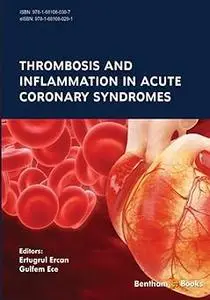 Thrombosis and Inflammation in Acute Coronary Syndromes