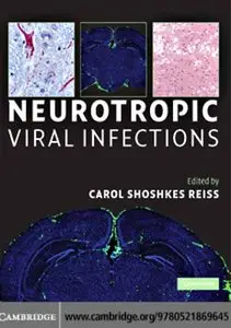 Neurotropic Viral Infections by Carol Shoshkes Reiss
