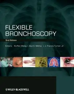 Flexible Bronchoscopy