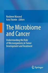 The Microbiome and Cancer