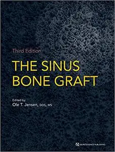 The Sinus Bone Graft (Repost)
