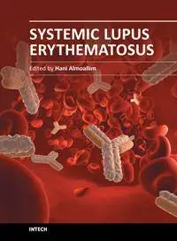 Systemic Lupus Erythematosus by Hani Almoallim