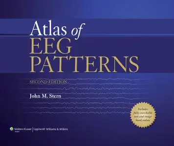 Atlas of EEG Patterns (Repost)