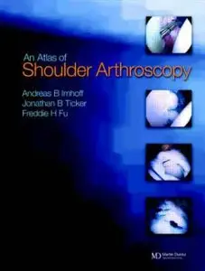 Atlas of Shoulder Arthroscopy by Andreas B. Imhoff