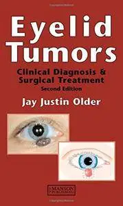 Eyelid Tumours: Clinical Diagnosis and Surgical Treatment, 2 edition