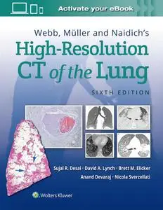 Webb, Müller and Naidich's High-Resolution CT of the Lung, 6th Edition