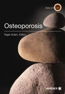 Osteoporosis (Repost)
