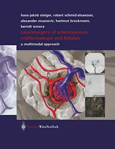 Neurosurgery of Arteriovenous Malformations and Fistulas: A Multimodal Approach