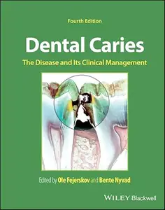 Dental Caries: The Disease and its Clinical Management, 4th Edition