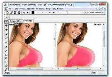 Virtual Plastic Surgery Soft 1.0.0.1484