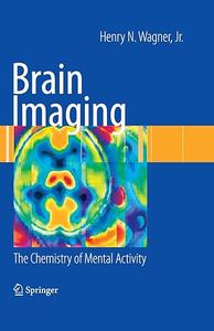 Brain Imaging: The Chemistry of Mental Activity (Repost)