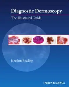 Diagnostic Dermoscopy: The Illustrated Guide