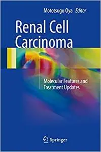 Renal Cell Carcinoma: Molecular Features and Treatment Updates (Repost)