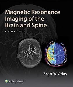 Magnetic Resonance Imaging of the Brain and Spine (Repost)