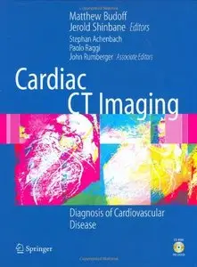 Cardiac CT Imaging: Diagnosis of Cardiovascular Disease by Matthew J. Budoff 
