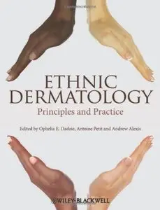 Ethnic Dermatology: Principles and Practice  