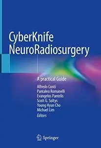 CyberKnife NeuroRadiosurgery: A practical Guide (Repost)